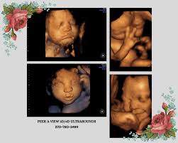 Image result for tbn:T5UajvfpShvp6M::www.photoslinks.com/index.php%3Foption%3Dcom_joomgallery%26func%3Dwatermark%26catid%3D4%26id%3D23%26Itemid%3D2