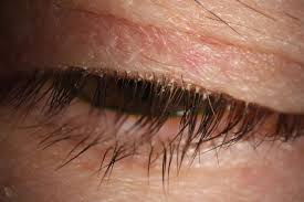 Image result for Blepharis bainesii