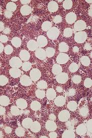 Concentrate on the preparation of a transverse bone section. Decalcified Bone Cross Section Lm Photograph By Science Stock Photography