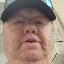 Nighttime urination after total knee replacement surgery