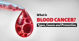 The three main types of blood and bone marrow cancer are leukemia, lymphoma and myeloma: What Is Blood Cancer Types Causes And Prevention