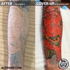 2.2 km away benowa qld 4217. Mj Driver Laser Tattoo Removal And Lightening Photos Facebook
