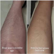 Hair must be long enough for the wax to adhere to for it to work effectively. How Quickly Does Hair Grow Back After Waxing