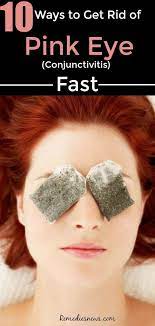 How To Get Rid Of Pink Eye Conjunctivitis Fast If You Are Suffering From Pink Eye Conjunctivitis And You Re Lookin Pink Eye Cure Pink Eyes Pinkeye Remedies