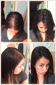 5 X5 Natural Straight Brazilian Virgin Remy Human Hair Lace Hair Topp Azwig Store Extensions For Thin Hair Hair Loss Women Thin Hair Styles For Women