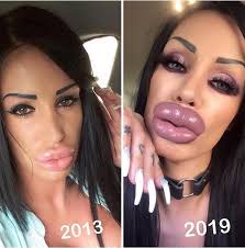 19 People Who Took Plastic Surgery Too Far Plastic Surgery Gone Wrong Bad Celebrity Plastic Surgery Botched Plastic Surgery