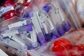 Combien de personnes ont été vaccinées contre la covid19 en france ? Appel International Pour Que Le Futur Vaccin Contre La Covid 19 Soit Disponible Pour Tous Onu Info