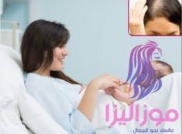 علاج تساقط الشعر بعد الولادة خلال ايام