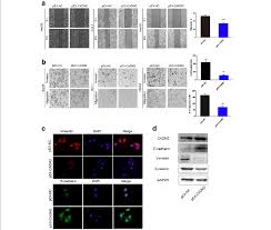 dysregulated of cadm2 mediated hcc cell migration and