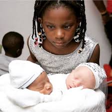 Ove bebe su rođene kao blizanci, no nećete vjerovati koliko su već danas  različiti