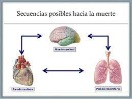 La muerte encefálica, como también se le conoce, es aceptada como una manera de morir. Muerte Cerebral Que Significa La Muerte Cerebral Y Que Pruebas Se Realizan Para Afirmar Con Contundencia Que El Paciente Legalmente Ha Fallecido Hay Dos Formas En La Que Una Persona Muera Por