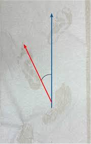 Image result for Foot Progression Angle