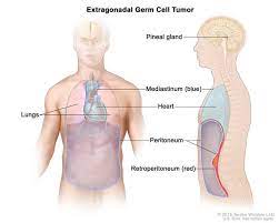 After birth, afp gene expression is turned down with a subsequent fall of the serum. What Is An Alpha Fetoprotein Afp Tumor Marker Test Dana Farber Cancer Institute