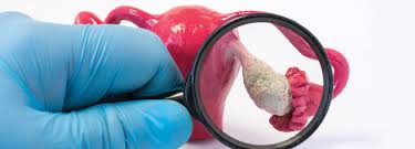 Signs and symptoms of pcos include irregular or no menstrual. Demystifying The Diagnosis Of Pcos Acp Internist
