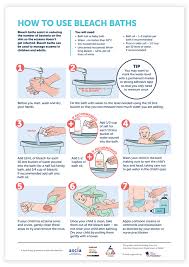 Eczema National Allergy Strategy