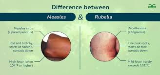 Image result for Rubella