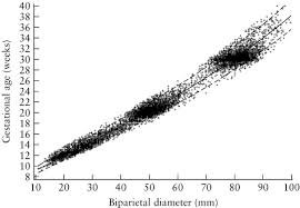 New Charts For Ultrasound Dating Of Pregnancy And Assessment