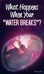 What does it look like when your water breaks. Pin On Healthy Pregnancy