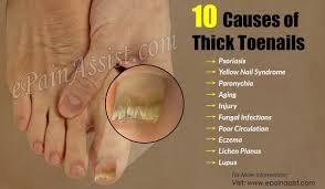Pin On Home Remedies For Various Medical Conditions