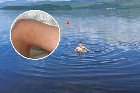The loch and its islands are used by visitors throughout the year for a range of recreation interests, including boating. Loch Lomond Wild Swimmers Warned Over Parasite After Skin Reaction Thefastnewz