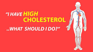 High cholesterol has no symptoms. I Have High Cholesterol What Should I Do Youtube