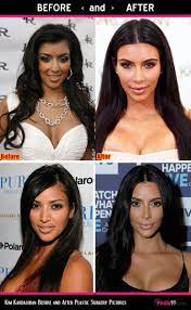 2007 this instantly iconic picture was taken at the very first keeping up with the kardashians viewing party—before kim had perfected her eyebrow shape. Kim Kardashian Face Pics Plastic Surgery Before And After Photo 6 Kim Kardashian Before Kardashian Plastic Surgery Kim Kardashian