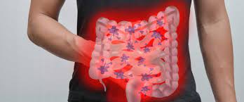 bagirsak enfeksiyonu nedir belirtileri nelerdir