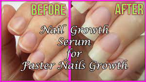 If you aren't naturally blessed with thick hair or if no worries, we've got the perfect diy nail growth serum for you! Homemade Nails Growth Serum How To Grow Nails Faster 100 Effective Youtube