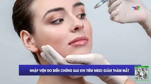 Nhập viện do biến chứng sau khi tiêm Meso giảm thâm mắt