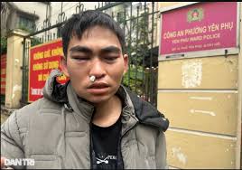 Tin mới nhất vụ shipper khuyết tật nhận 20 cú đánh, đấm trong 30 giây: Tài  xế Lexus vừa nhận tin dữ