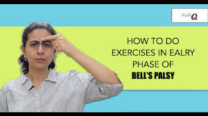 Research shows bell's palsy afflicts approximately 40,000 americans every year. Facial Exercises In Early Phase Of Bell S Palsy Youtube
