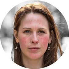 Then, 4 to 5 years ago, i heard about soolantra, i got it on prescription and since then i haven't used anything else, it's brilliant, it works quickly and the redness and pustules reduce within 2 days. About Soolantra Ivermectin Cream Proposed Moa And Application