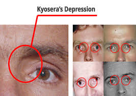 What do a psychopath's eyes typically look like?