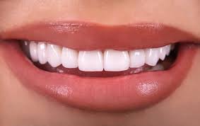 The Top Concern Patients Have About Dental Veneers - Advanced Family  Dentistry Tucson Arizona