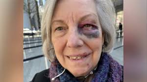 New York City tourist suffers black eye, chipped tooth after being  intentionally tripped