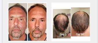 Hi ladies, my hair is starting to thin with age which I know is normal but  I already have very fine thin hair to begin with. I'm already