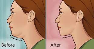 The Best 5 Double Chin Exercises Double Chin Chin Exercises Reduce Double Chin