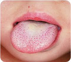 اسحب المؤشر حول كائن لتكوين مستطيل. Ù„Ù…Ø§Ø°Ø§ ÙŠØªØ­ÙˆÙ„ Ù„ÙˆÙ† Ø§Ù„Ù„Ø³Ø§Ù† ÙØ¬Ø§Ø© Ù„Ù„ÙˆÙ† Ø§Ù„Ø£Ø¨ÙŠØ¶ Ø§Ù„Ù…Ø¯ÙŠÙ†Ø© Ù†ÙŠÙˆØ²