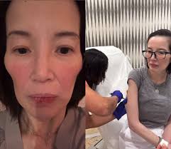 I still want to live:' Kris Aquino reveals worsening health condition