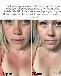 In winter time do you really need the anti jelly fuel treatment? And how  much do you go through