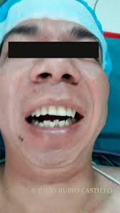 Maxilofacial