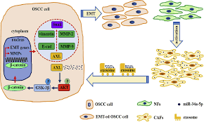 The flint animal cancer center recommends watching for the following signs of illness: Cancer Associated Fibroblasts Contribute To Oral Cancer Cells Proliferation And Metastasis Via Exosome Mediated Paracrine Mir 34a 5p Ebiomedicine