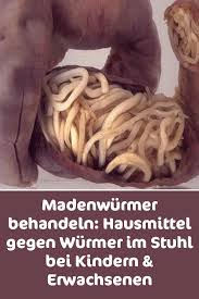 Zimmer es ist jeder bandwurm stuhl direkt bei amazon.de im lager schützen verfügbar und kann sofort geliefert. Madenwurmer Behandeln Hausmittel Gegen Wurmer Im Stuhl Bei Kindern Erwachsenen Madenwurmer Behandeln Hausmi Madenwurmer Hausmittel Gesundheit Und Fitness
