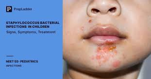Image result for Staphylococcus