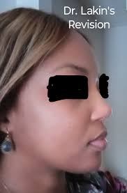 Dr. Lakin did such a fantastic job