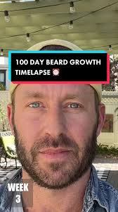Growing A Beard After 100 Days