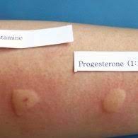 Intradermal Testing With Progesterone 1 10 1 1 Was Positive After Download Scientific Diagram