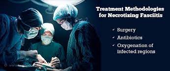 Necrotizing Fasciitis (Nf) | Flesh-Eating Disease - Causes, Risk Factors,  Symptoms, Diagnosis, Treatment And Prevention