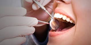 We did not find results for: Gigi Geraham Bungsu Perlukah Dioperasi Merdeka Com