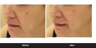 Klinik pakar kulit md noh skin treatments specialised 87, tingkat 1, wisma mohd ebrahim, jalan tuanku abdul rahman, kuala lumpur the username @klinikpakarkulitdrmohdnoh has been created for klinik pakar kulit dr mohd noh. Lagenda Medical Clinic Home Facebook